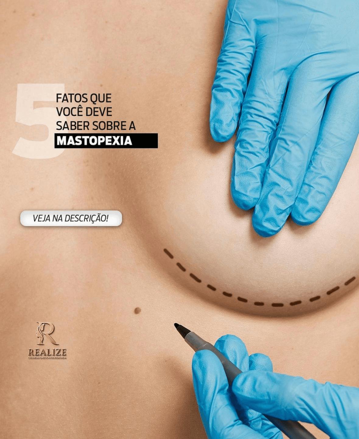 3ª imagem da campanha